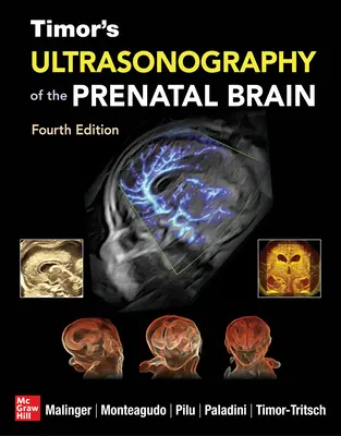 Timor's Ultrasonography of the Prenatal Brain, ediția a patra - Timor's Ultrasonography of the Prenatal Brain, Fourth Edition