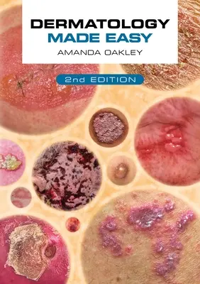 Dermatologie ușoară, ediția a doua - Dermatology Made Easy, Second Edition