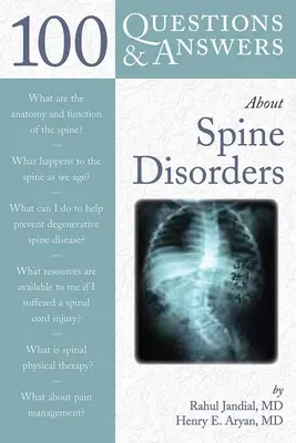 100 de întrebări și răspunsuri despre afecțiunile coloanei vertebrale - 100 Q&as about Spine Disorders