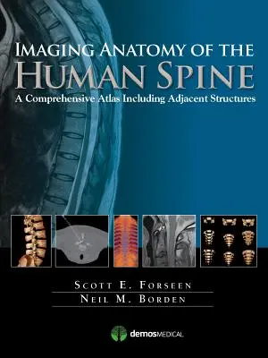 Anatomia imagistică a coloanei vertebrale umane: Un atlas cuprinzător care include structurile adiacente - Imaging Anatomy of the Human Spine: A Comprehensive Atlas Including Adjacent Structures