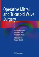 Chirurgia operativă a valvelor mitrală și tricuspidă - Operative Mitral and Tricuspid Valve Surgery