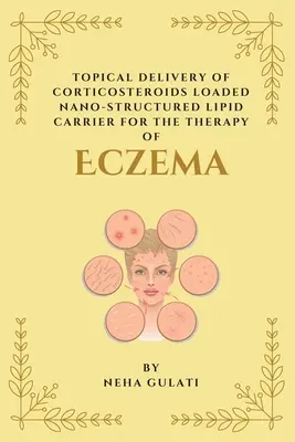 Livrarea topică de corticosteroizi încărcați cu purtători lipidici nanostructurați pentru terapia eczemelor - Topical Delivery of Corticosteroids Loaded Nanostructured Lipid Carrier for the Therapy of Eczema