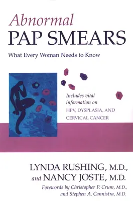 Papanicolau anormal: Ce trebuie să știe fiecare femeie - Abnormal Pap Smears: What Every Woman Needs to Know
