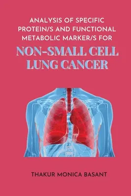 Analiza proteinei specifice S și a markerului metabolic funcțional S pentru plămânul fără celule mici - Analysis of Specific Protein S and Functional Metabolic Marker S for Non Small Cell Lung