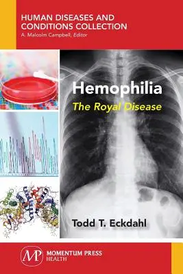 Hemofilia: Boala regală - Hemophilia: The Royal Disease