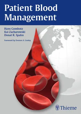 Managementul sângelui pacientului - Patient Blood Management