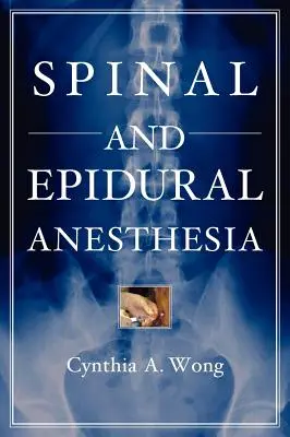 Anestezia spinală și epidurală - Spinal and Epidural Anesthesia