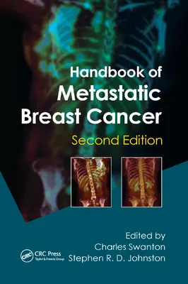 Manual de cancer mamar metastatic - Handbook of Metastatic Breast Cancer