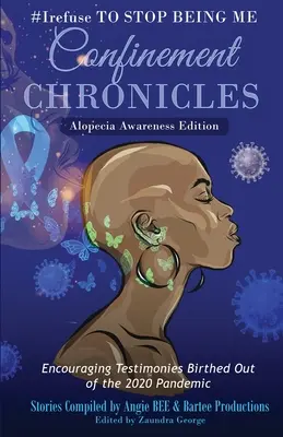 #Irefuse to Stop Being Me: Cronici de detenție - Ediția de conștientizare a alopeciei - #Irefuse to Stop Being Me: Confinement Chronicles - Alopecia Awareness Edition