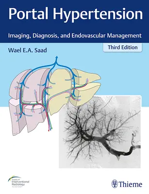 Hipertensiunea portală: Imagistică, diagnostic și management endovascular - Portal Hypertension: Imaging, Diagnosis, and Endovascular Management