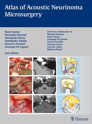 Atlas de microchirurgie a neurinomului acustic - Atlas of Acoustic Neurinoma Microsurgery