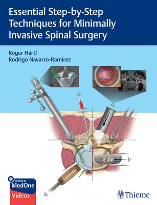 Tehnici esențiale pas cu pas pentru chirurgia minim invazivă a coloanei vertebrale - Essential Step-By-Step Techniques for Minimally Invasive Spinal Surgery