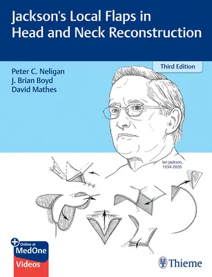 Lambourile locale ale lui Jackson în reconstrucția capului și gâtului - Jackson's Local Flaps in Head and Neck Reconstruction