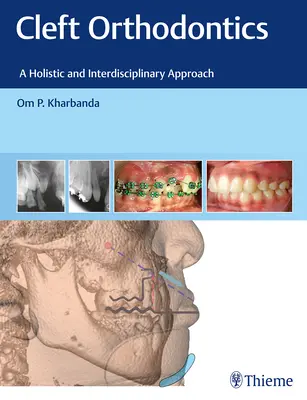 Cleft Orthodontics: O abordare holistică și interdisciplinară - Cleft Orthodontics: A Holistic and Interdisciplinary Approach
