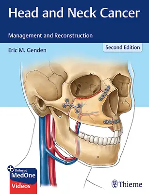 Cancerul de cap și gât: Management și reconstrucție - Head and Neck Cancer: Management and Reconstruction