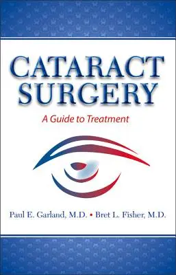 Chirurgia cataractei: Un ghid pentru tratament - Cataract Surgery: A Guide to Treatment