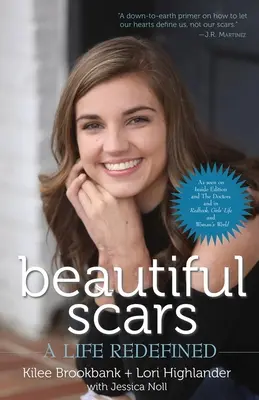 Beautiful Scars: O viață redefinită - Beautiful Scars: A Life Redefined