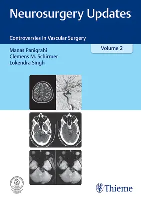 Neurosurgery Updates, Vol. 2: Controverse în chirurgia vasculară - Neurosurgery Updates, Vol. 2: Controversies in Vascular Surgery