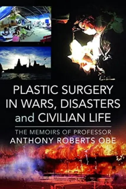 Chirurgia plastică în războaie, dezastre și viața civilă: Memoriile profesorului Anthony Roberts OBE - Plastic Surgery in Wars, Disasters and Civilian Life: The Memoirs of Professor Anthony Roberts OBE