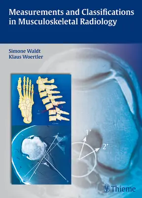 Măsurători și clasificări în radiologia musculo-scheletală - Measurements and Classifications in Musculoskeletal Radiology