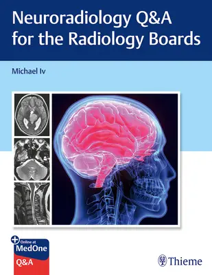 Neuroradiologie Q&A pentru examenele de radiologie - Neuroradiology Q&A for the Radiology Boards