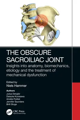 Obscura articulație sacroiliacă: Insights Into Anatomy, Biomechanics, Etiology and the Treatment of Mechanical Dysfunction - The Obscure Sacroiliac Joint: Insights Into Anatomy, Biomechanics, Etiology and the Treatment of Mechanical Dysfunction
