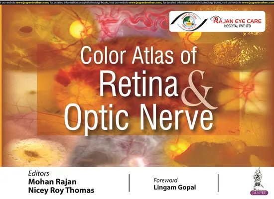 Atlas color al retinei și nervului optic - Color Atlas of Retina & Optic Nerve