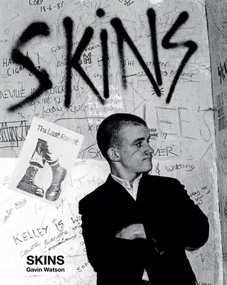 Piele: Gavin Watson - Skins: Gavin Watson
