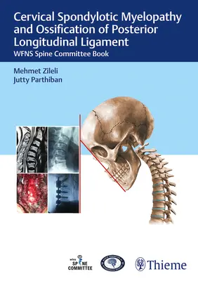 Mielopatia spondilotică cervicală și osificarea ligamentului longitudinal posterior: Cartea Comitetului Wfns Spine - Cervical Spondylotic Myelopathy and Ossification of Posterior Longitudinal Ligament: Wfns Spine Committee Book