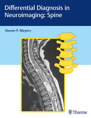 Diagnosticul diferențial în neuroimagistică: Coloana vertebrală - Differential Diagnosis in Neuroimaging: Spine