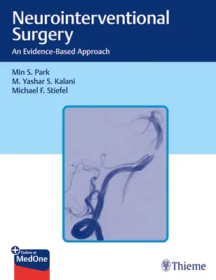 Chirurgia neurointervențională: O abordare bazată pe dovezi - Neurointerventional Surgery: An Evidence-Based Approach
