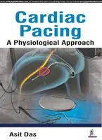 Stimularea cardiacă: o abordare fiziologică - Cardiac Pacing a Physiological Approach