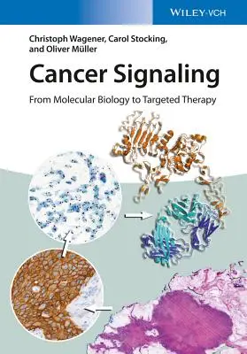 Semnalizarea cancerului: De la biologia moleculară la terapia țintită - Cancer Signaling: From Molecular Biology to Targeted Therapy