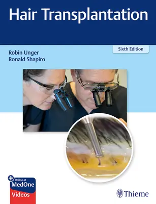 Transplantul de păr - Hair Transplantation