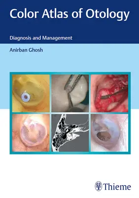 Atlas color de otologie: Diagnostic și management - Color Atlas of Otology: Diagnosis and Management