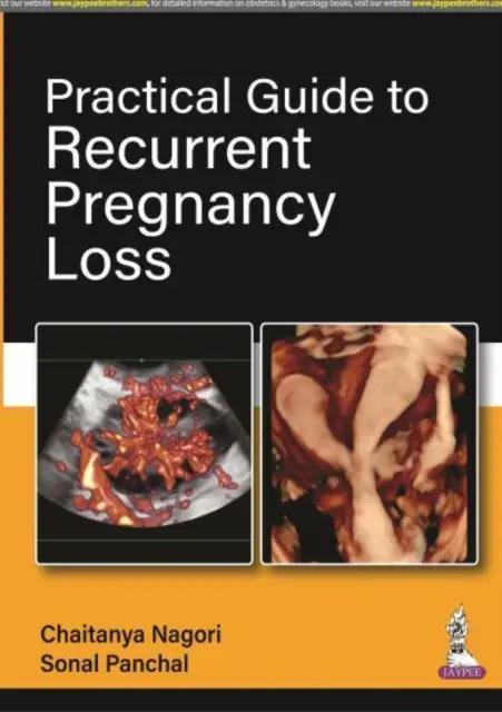 Ghid practic pentru pierderea recurentă a sarcinii - Practical Guide to Recurrent Pregnancy Loss