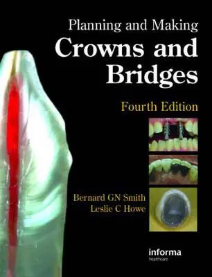 Planificarea și realizarea coroanelor și a podurilor - Planning and Making Crowns and Bridges