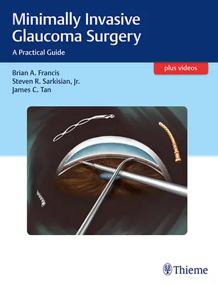 Chirurgia minim invazivă a glaucomului: Un ghid practic - Minimally Invasive Glaucoma Surgery: A Practical Guide