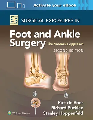Surgical Exposures in Foot and Ankle Surgery: Abordarea anatomică - Surgical Exposures in Foot and Ankle Surgery: The Anatomic Approach