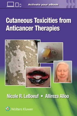 Reacții cutanate la terapiile anticancerigene - Cutaneous Reactions from Anti-Cancer Therapies