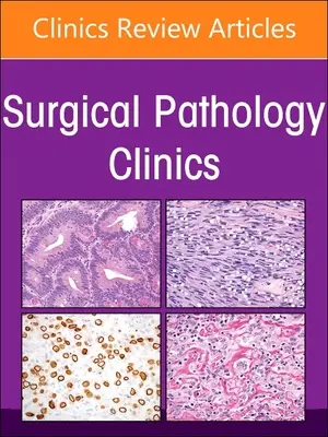 Endocrine Pathology, un număr din Surgical Pathology Clinics: Volumul 16-1 - Endocrine Pathology, an Issue of Surgical Pathology Clinics: Volume 16-1