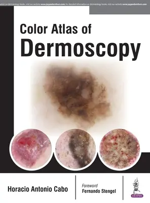 Atlas color de dermatoscopie - Color Atlas of Dermoscopy