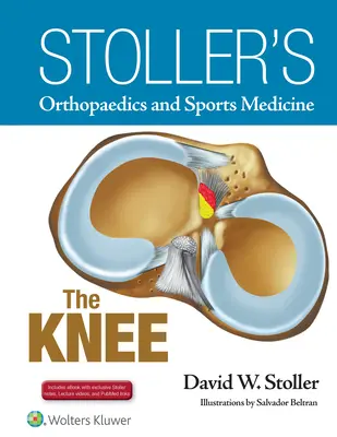 Stoller's Orthopaedics and Sports Medicine: Genunchiul: Include videoclipuri cu prelegeri Stoller și note Stoller - Stoller's Orthopaedics and Sports Medicine: The Knee: Includes Stoller Lecture Videos and Stoller Notes