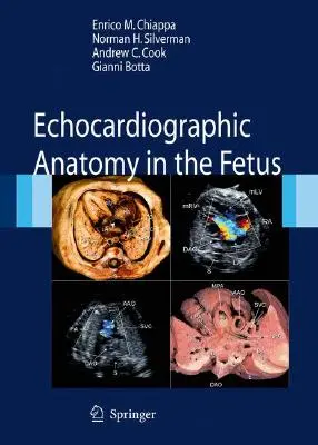 Anatomia ecocardiografică la făt [Cu DVD] - Echocardiographic Anatomy in the Fetus [With DVD]