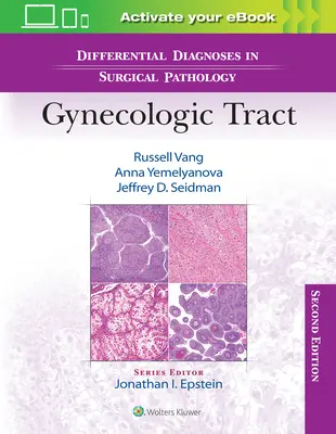 Diagnostice diferențiale în patologia chirurgicală: Tractul ginecologic - Differential Diagnoses in Surgical Pathology: Gynecologic Tract