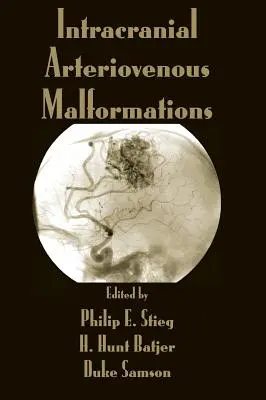 Malformații arteriovenoase intracraniene - Intracranial Arteriovenous Malformations