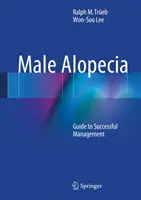 Alopecia masculină: Ghid pentru gestionarea cu succes - Male Alopecia: Guide to Successful Management