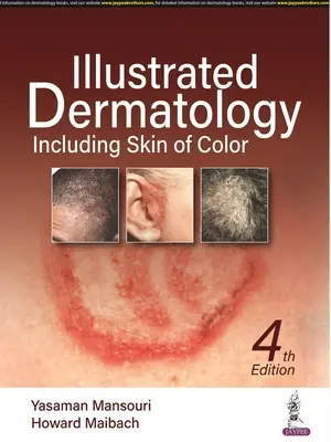 Dermatologie ilustrată - inclusiv pielea de culoare - Illustrated Dermatology - Including Skin of Colour