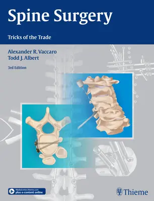 Chirurgia coloanei vertebrale: Trucuri de meserie - Spine Surgery: Tricks of the Trade
