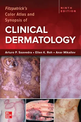 Fitzpatrick's Color Atlas and Synopsis of Clinical Dermatology, ediția a noua - Fitzpatrick's Color Atlas and Synopsis of Clinical Dermatology, Ninth Edition